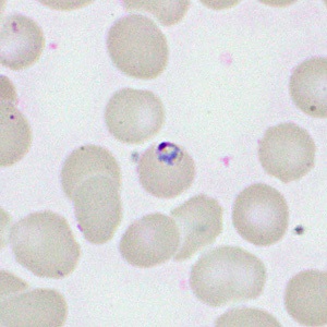 Case460_B parasitic image