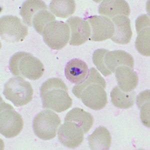 Case460_F parasitic image