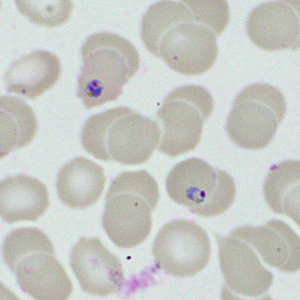Case460_G parasitic image