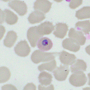 Case460_H parasitic image
