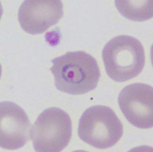 Case461_A Parasitic image