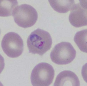 Case461_D Parasitic image