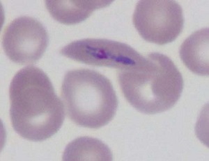 Case461_E Parasitic image