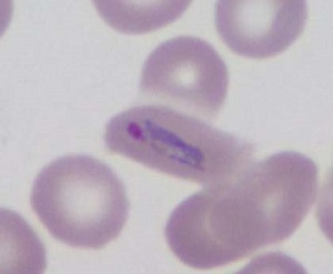 Case461_F Parasitic image