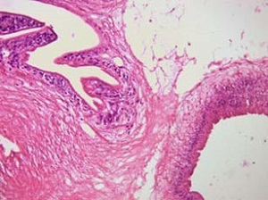 Case462_B Parasitic image
