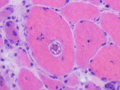 Case463_B Parasitic image