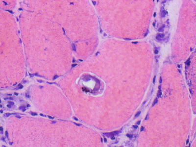 Case463_C Parasitic image
