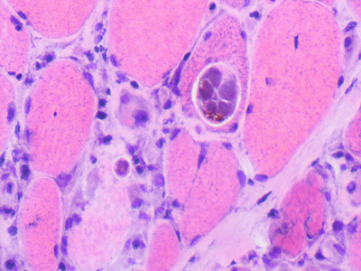 Case463_E Parasitic image