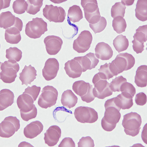 Case464_A Parasitic image