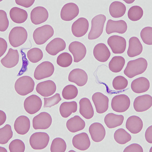 Case464_B Parasitic image