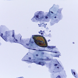 Case465_A Parasitic image