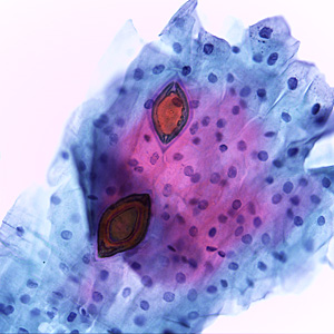 Case465_B Parasitic image