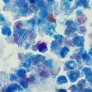 OLYMPUS DIGITAL CAMERA Parasitic image