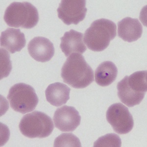 JUNE - 2018 - Case #469 parasitic image