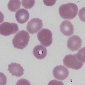 Case469_D Parasitic image