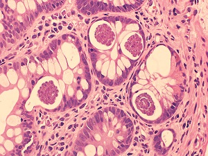 JUNE - 2018 - Case #470 parasitic image