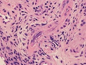 Case470_E parasitic image