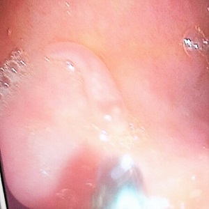 Case472_A parasitic image