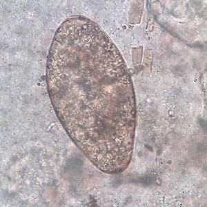 Case472_C parasitic image