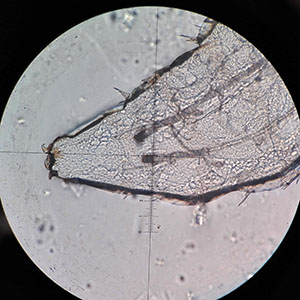 Case476_E parasitic image