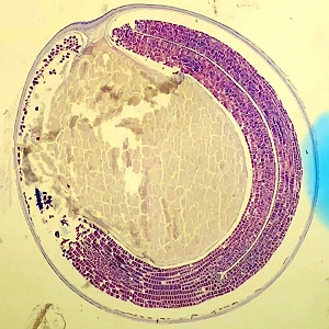 Case477_A parasitic image