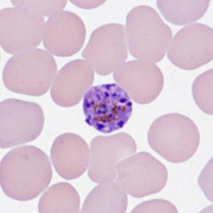 Case478_C parasitic image