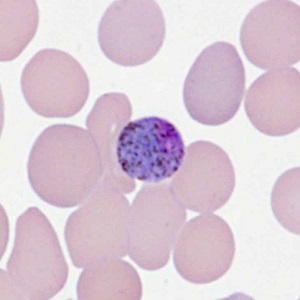 Case478_D parasitic image