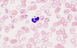 Case480_B parasitic image