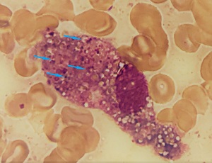 Case480_C Answer parasitic image
