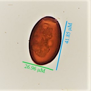 DECEMBER - 2018 - CASE #482 parasitic image