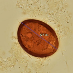 Case482_B Parasitic Image