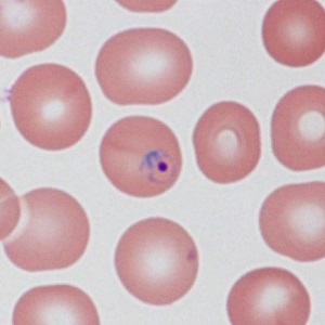 Case485_A Parasitic image