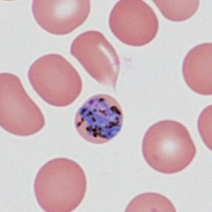 Case485_B Parasitic image