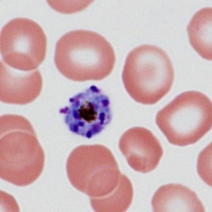 Case485_C Parasitic image