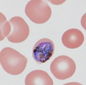 Case485_E Parasitic image