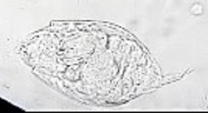 Case486_A Parasitic image
