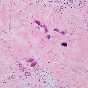 Case487_A parasitic image