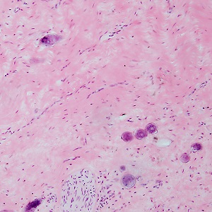 Case487_B parasitic image