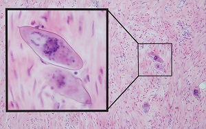 Case487_C parasitic image