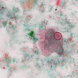Case488_A parasitic image