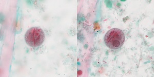 Case488_D parasitic image