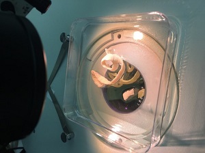 APRIL - 2019 - CASE #489 Figure A