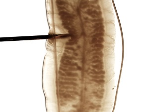 Case489_C Answer Figure C