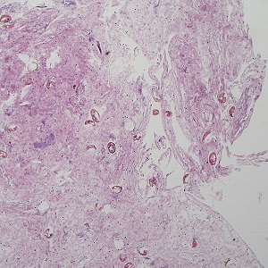 JULY - 2019 - CASE #495 parasitic image