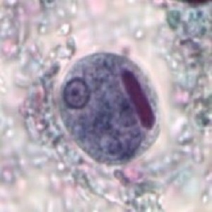 AUGUST - 2019 - CASE #497 parasitic image