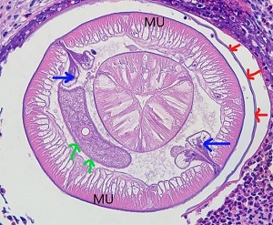 Case498_B_Answer Figure B