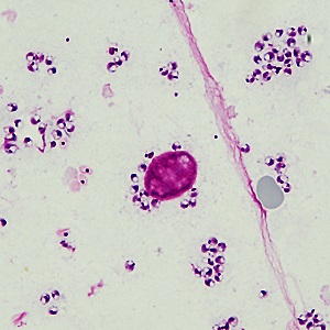 DECEMBER - 2019 - CASE #505 parasitic image