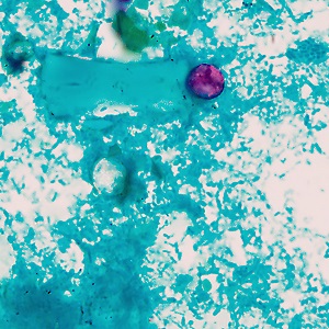 Case506_D_Ans Figure