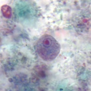 NOVEMBER - 2019 - CASE #503 parasitic image