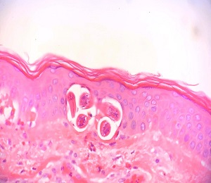 SEPTEMBER - 2020 - CASE #523 parasitic image